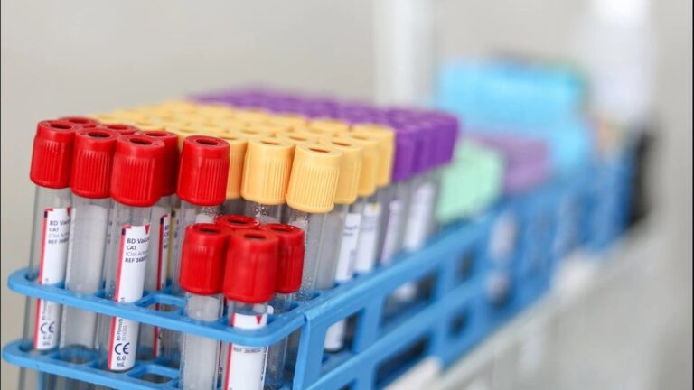 Bloedafname in de praktijk vanaf 1 april