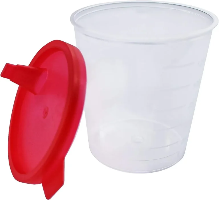 Urine inleveren voor 9.30 uur